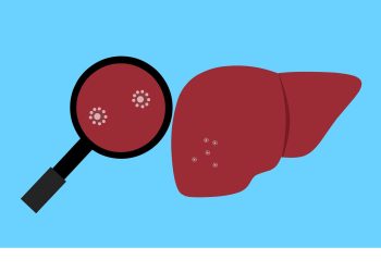 Enzima LARS, o posibilă țintă în tratamentul cancerului hepatic