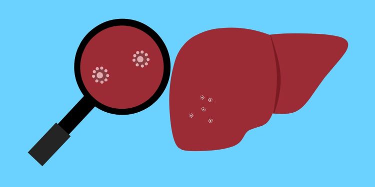 Enzima LARS, o posibilă țintă în tratamentul cancerului hepatic